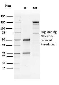 Antibody anti-GATA3 GATA32441 100 µg