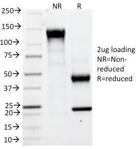 SDS-PAGE analysis of Anti-Carbonic Anhydrase IX Antibody [CA9/781] under non-reduced and reduced conditions; showing intact IgG and intact heavy and light chains, respectively SDS-PAGE analysis confirms the integrity and purity of the antibody