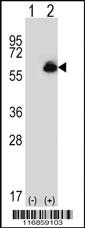 Anti-NR2F1 Rabbit Polyclonal Antibody