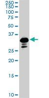 Anti-SMAD3 Mouse Monoclonal Antibody [clone: 7F3]