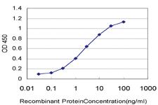 Anti-MAP4K4 Mouse Monoclonal Antibody [clone: 4A5]