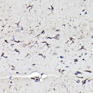 Immunohistochemistry analysis of paraffin-embedded mouse brain using Anti-Vimentin Antibody (A308844) at a dilution of 1:100 (40X lens). Perform high pressure antigen retrieval with 10 mM citrate buffer pH 6.0 before commencing with IHC staining protocol