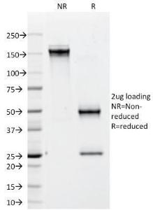 SDS-PAGE analysis of Anti-CD79b Antibody [IGB/1842] under non-reduced and reduced conditions; showing intact IgG and intact heavy and light chains, respectively. SDS-PAGE analysis confirms the integrity and purity of the antibody