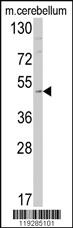 Anti-EDNRB Rabbit Polyclonal Antibody