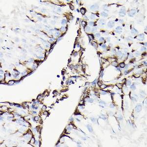 Immunohistochemistry analysis of paraffin-embedded rat testis using Anti-Vimentin Antibody (A308844) at a dilution of 1:100 (40X lens). Perform high pressure antigen retrieval with 10 mM citrate buffer pH 6.0 before commencing with IHC staining protocol