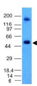 Western blot analysis of HCT116 cell lysate using Anti-Carbonic Anhydrase IX Antibody [CA9/781]