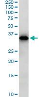 Anti-SMAD3 Mouse Monoclonal Antibody [clone: 7F3]