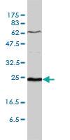 Anti-SDF2 Mouse Monoclonal Antibody [clone: 3G7-1D6]