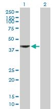 Anti-AADAT Mouse Polyclonal Antibody