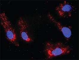 Anti-IL21 + DGKA Antibody Pair