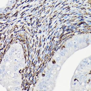 Immunohistochemistry analysis of paraffin-embedded rat uterus using Anti-Vimentin Antibody (A308844) at a dilution of 1:100 (40X lens). Perform high pressure antigen retrieval with 10 mM citrate buffer pH 6.0 before commencing with IHC staining protocol