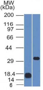 Western blot analysis of (Lane 1) human CD79b recombinant fragment and (Lane 2) Raji cell lysate using Anti-CD79b Antibody [IGB/1843]