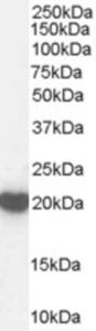 EB07284 (1 µg/ml) staining of Human Brain lysate (35 µg protein in RIPA buffer).  Primary incubation was 1 hour.  Detected by chemiluminescence.