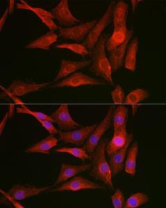 Immunofluorescence analysis of NIH-3T3 cells using Anti-Vimentin Antibody (A308844) at a dilution of 1:50 (40X lens). DAPI was used to stain the cell nuclei (blue)