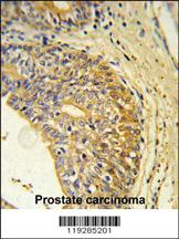 Anti-EDNRB Rabbit Polyclonal Antibody