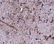 Anti-TOMM70A Rabbit Polyclonal Antibody