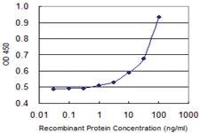 Anti-GALNT14 Mouse Monoclonal Antibody [clone: 2A8]