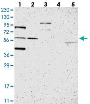 Anti-C1ORF116 Rabbit Polyclonal Antibody