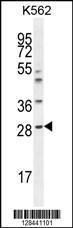 Anti-APCS Rabbit Polyclonal Antibody (FITC (Fluorescein Isothiocyanate))