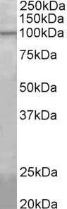 Antibody anti-AGBL5 100 µg