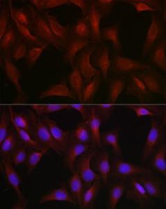 Immunofluorescence analysis of U-2 OS cells using Anti-Vimentin Antibody (A308844) at a dilution of 1:50 (40X lens). DAPI was used to stain the cell nuclei (blue)