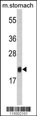 Anti-FKBP11 Rabbit Polyclonal Antibody