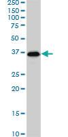 Anti-SMAD3 Mouse Monoclonal Antibody [clone: 7F3]