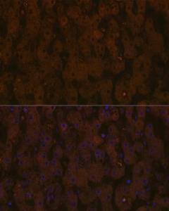 Immunofluorescence analysis of human liver using Anti-Apolipoprotein CIII Antibody [ARC1886] (A307674) at a dilution of 1:100 (40x lens). DAPI was used to stain the cell nuclei (blue)