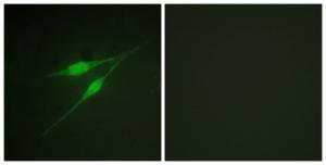 Anti-p38 MAPK alpha Rabbit Polyclonal Antibody