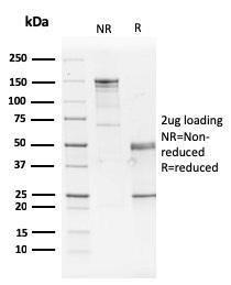 SDS-PAGE analysis of Anti-GATA3 Antibody [GATA3/2442] under non-reduced and reduced conditions; showing intact IgG and intact heavy and light chains, respectively. SDS-PAGE analysis confirms the integrity and purity of the antibody.