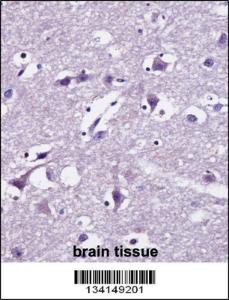 Anti-SEC22B Rabbit Polyclonal Antibody (FITC (Fluorescein Isothiocyanate))