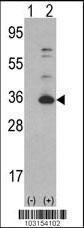 Anti-CDK4 Rabbit Polyclonal Antibody (AP (Alkaline Phosphatase))