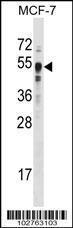 Anti-SETD7 Rabbit Polyclonal Antibody (AP (Alkaline Phosphatase))