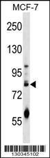 Anti-ACRC Rabbit Polyclonal Antibody (PE (Phycoerythrin))