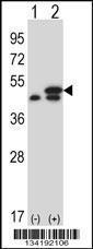 Anti-EEF1G Rabbit Polyclonal Antibody (APC (Allophycocyanin))