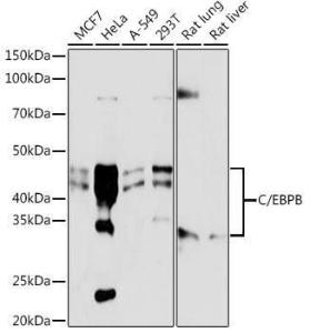 Western blot analysis of extracts of various cell lines, using Anti-CEBP Beta Antibody [ARC0017] (A308846) at 1:1,000 dilution