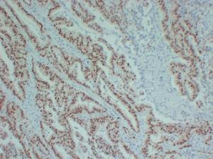 Anti-SOX9 Mouse Monoclonal Antibody [clone: ABT-SOX9]