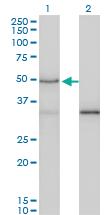 Anti-SMAD3 Mouse Monoclonal Antibody [clone: 7F3]