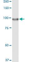 Anti-DGKA Polyclonal Antibody Pair