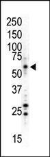 Anti-MAPK8 Rabbit Polyclonal Antibody (AP (Alkaline Phosphatase))