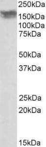 Anti-CD56 Antibody (A82568) (001 µg/ml) staining of Human Frontal Cortex lysate (35 µg protein in RIPA buffer) Primary incubation was 1 hour Detected by chemiluminescence