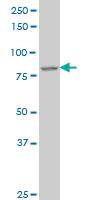 Anti-DAZ1 Mouse Monoclonal Antibody [clone: 3G10]