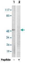 Anti-FOXN4 Rabbit Polyclonal Antibody