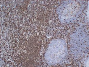 Immunohistochemical analysis of paraffin-embedded human Tonsil using Anti-CD43 Antibody