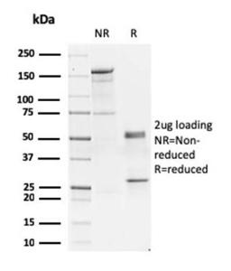 SDS-PAGE analysis of Anti-GATA3 Antibody [GATA3/2444] under non-reduced and reduced conditions; showing intact IgG and intact heavy and light chains, respectively SDS-PAGE analysis confirms the integrity and purity of the antibody