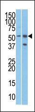 Anti-RMP (URI) Rabbit Polyclonal Antibody