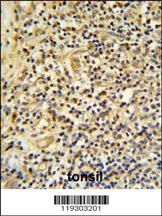 Anti-FKBP11 Rabbit Polyclonal Antibody