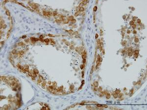 Anti-DAZ1 Mouse Monoclonal Antibody [clone: 3G10]