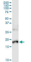 Anti-IL17F Polyclonal Antibody Pair