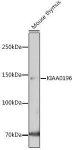 Western blot analysis of extracts of Mouse thymus, using Anti-Strumpellin Antibody (A308848) at 1:1,000 dilution. The secondary antibody was Goat Anti-Rabbit IgG H&L Antibody (HRP) at 1:10,000 dilution.